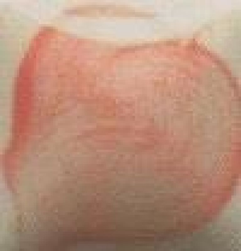 Melon