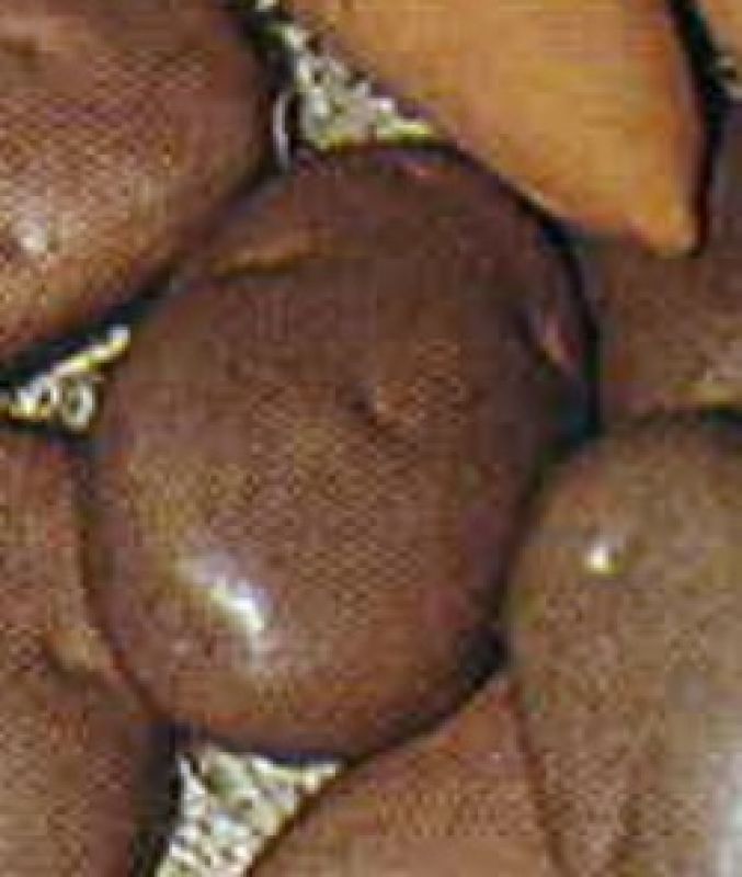 Potatoes